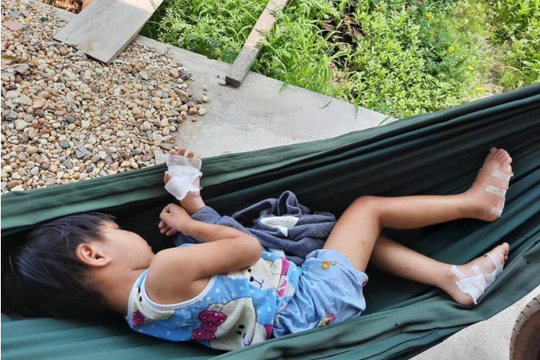 Xử lý nghiêm vụ cha dượng bạo hành dã man bé gái 4 tuổi ở Tây Ninh