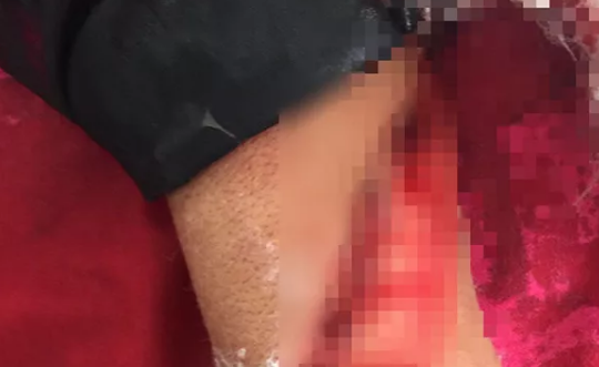 Gã đàn ông vung dao chém người tình trọng thương rồi trốn vào rừng