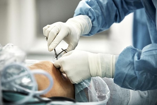 Bé gái bị máy xay đá cuốn tóc lột hết da đầu