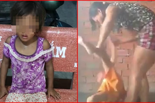 Liên tiếp những vụ cha mẹ bạo hành con trẻ khiến dư luận phẫn nộ