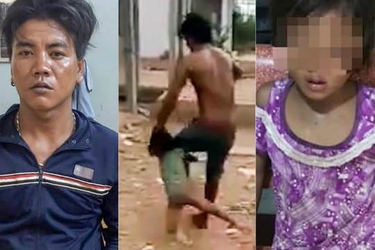 Khởi tố, bắt giam người cha đánh con gái 6 tuổi đa chấn thương