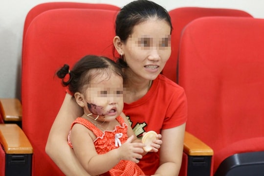 3 trẻ nhỏ bị chó tấn công gây thương tích nghiêm trọng