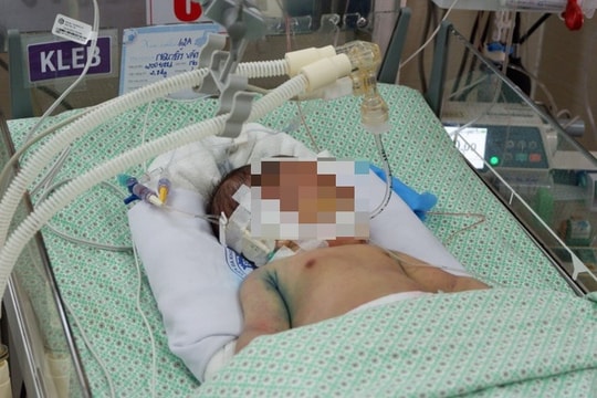 Bé sơ sinh bị bỏ rơi dưới hố ga không qua khỏi sau 21 ngày điều trị