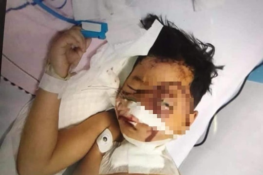 Xót thương bé trai 7 tuổi bị tai nạn nguy kịch khi theo mẹ đi làm gạch