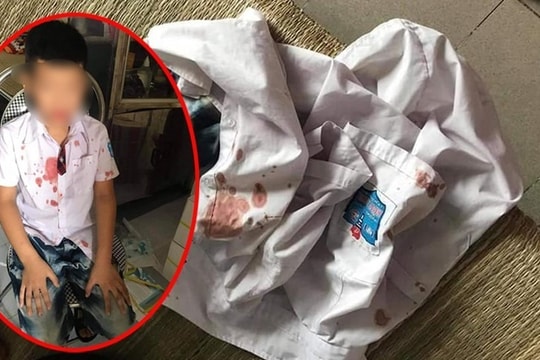 Phụ huynh đánh học sinh lớp 1 trọng thương để giải quyết mâu thuẫn cho con