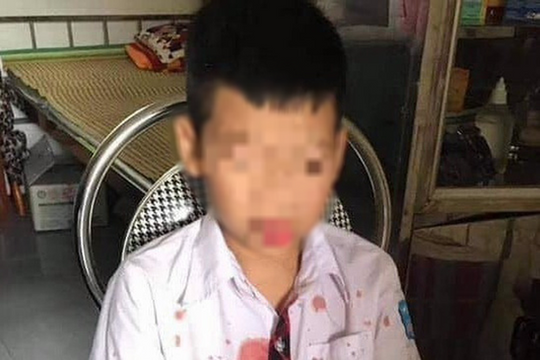 Phụ huynh có máu côn đồ, hãy xử lý hình sự