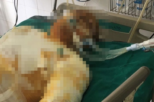 Khởi tố kẻ đổ xăng đốt đồng nghiệp