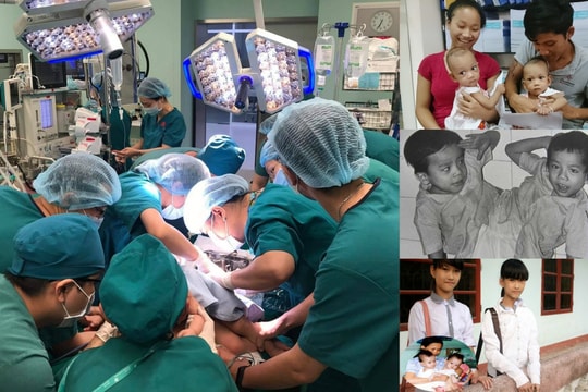 Những ca phẫu thuật tách rời cặp song sinh dính liền thành công ở Việt Nam