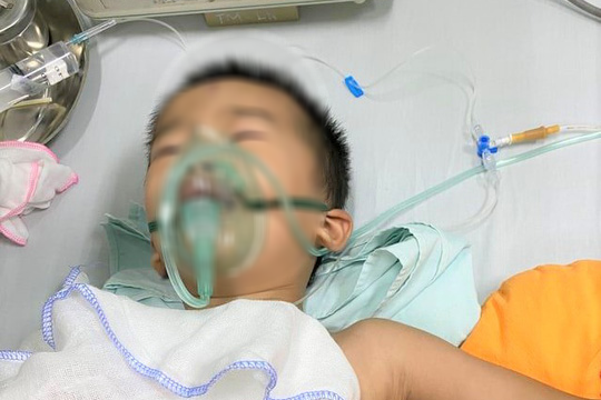 Cứu sống bé trai 4 tuổi bị trâu húc thủng phổi