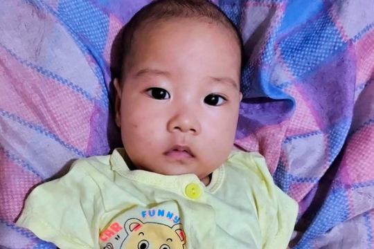 Bé trai bị teo thực quản đã được phẫu thuật, sức khỏe tốt lên