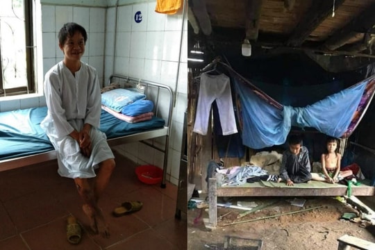 Gia cảnh khốn khó của người đàn ông "gà trống nuôi con" bị hoại tử chân