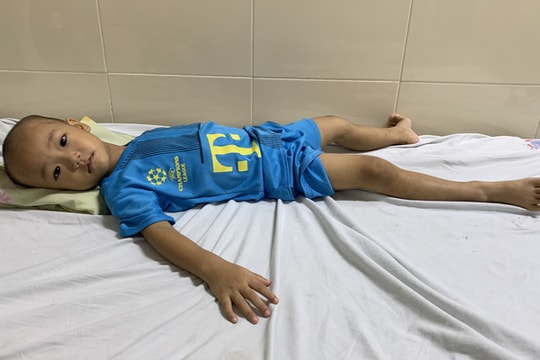 Gia cảnh đáng thương của cặp vợ chồng có con lớn 3 tuổi mắc ung thư, con út bị bệnh down