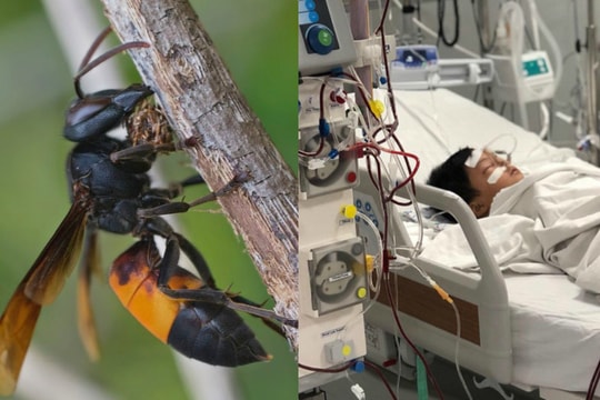 Những cái chết thương tâm vì ong vò vẽ tấn công, bác sĩ chỉ cách sơ cứu đúng