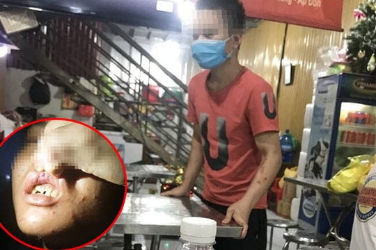 Chủ quán bánh xèo bạo hành nhân viên dã man ở Bắc Ninh có thể bị phạt tù