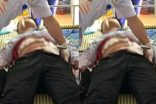 Nam sinh lớp 9 đâm bạn trọng thương ở Yên Bái có bị truy cứu hình sự?
