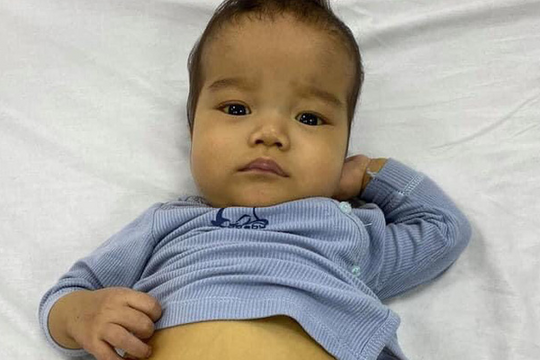 Người mẹ đơn thân chỉ biết nhìn con trai 11 tháng da vàng, bụng căng tròn như “trống” vì nghèo khó