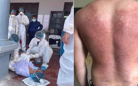 Hình ảnh nhân viên y tế giữa tâm dịch làm lay động hàng triệu trái tim