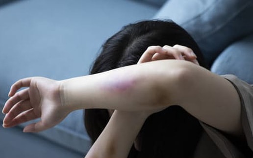 Bố đánh con vì làm bài thi vào lớp 10 không tốt, xử lý thế nào?