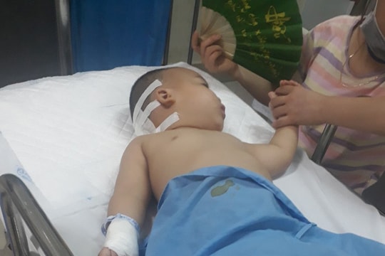 Xót xa hoàn cảnh bé trai 2 tuổi mờ hai mắt vì căn bệnh u não