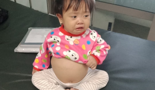 Sự sống mong manh của bé gái bụng to như trống vì bệnh hiểm nghèo