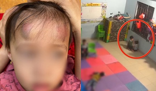 Vụ bé gái 2 tuổi bị bé trai 3 tuổi cùng lớp đánh đập dã man: Rất có thể đứa trẻ bị ảnh hưởng của game bạo lực?