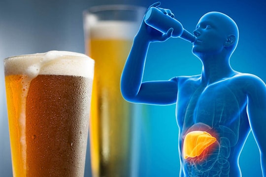 Bệnh gan do rượu: Triệu chứng và yếu tố nguy cơ ai cũng cần phải biết
