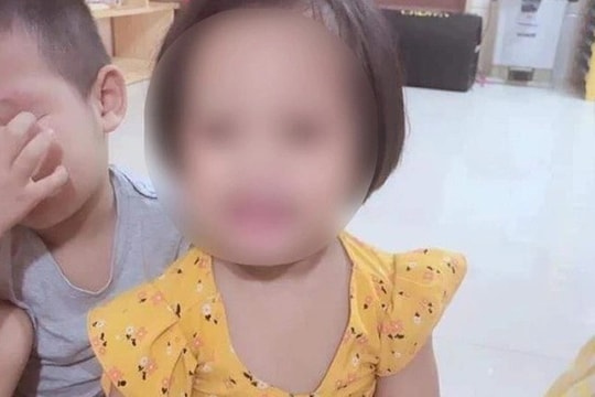 Diễn biến mới về sức khỏe của bé gái 3 tuổi bị ghim đinh vào đầu