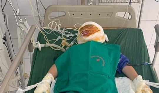 Chập điện cháy nhà khiến ba anh em mồ côi người mất, người cấp cứu trong nguy kịch