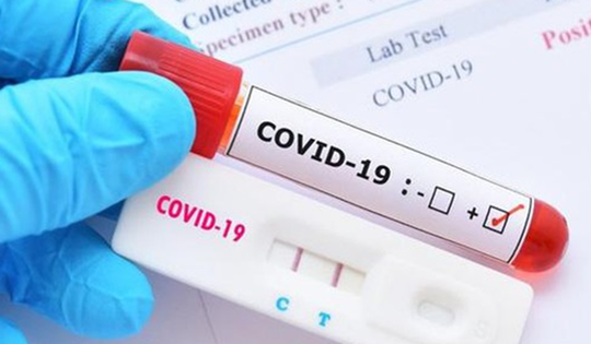 Cơ sở y tế tư nhân không được lợi dụng dịch bệnh để tăng giá xét nghiệm COVID-19