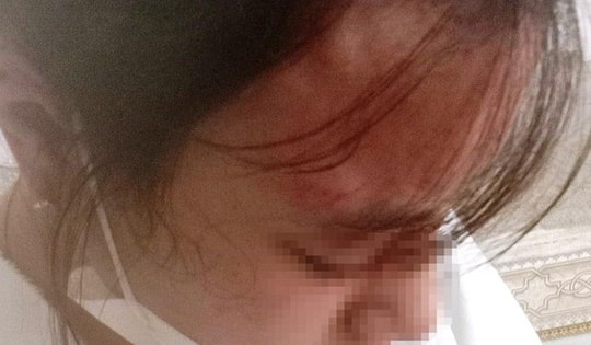 Khởi tố chủ quán tạp hóa hành hung nữ sinh lớp 10