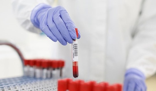 Số ca mắc giảm rất mạnh, Hà Nội tập trung phát hiện sớm biến thể SARS-CoV-2 mới có thể xâm nhập, lây lan