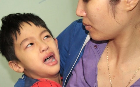 Tiếng khóc xé lòng bé trai 6 tuổi mắc bệnh u não ở Hải Dương và nỗi khổ hạnh của hai vợ chồng trẻ