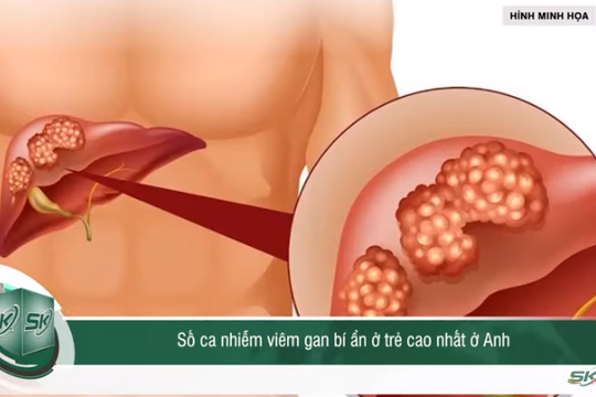 Sáng 12/5: Số ca nhiễm viêm gan bí ẩn ở trẻ cao nhất ở Anh, đã có ca bệnh phải ghép gan