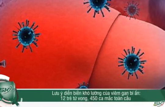 Hoảng hốt diễn biến khó lường của viêm gan bí ẩn: 12 trẻ tử vong, 450 ca mắc tàn cầu