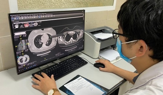 Sáng 22/5: Bộ Y tế hướng dẫn các việc nên làm để tránh tình trạng 'sương mù não' của hậu COVID-19