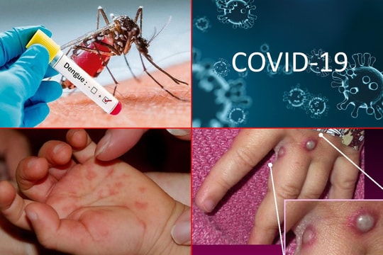 Nhiều bệnh truyền nhiễm có nguy cơ bùng phát, Bộ Y tế yêu cầu tăng cường phòng tránh dịch