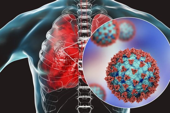 Cảnh báo virus thay đổi bất thường hậu COVID-19 