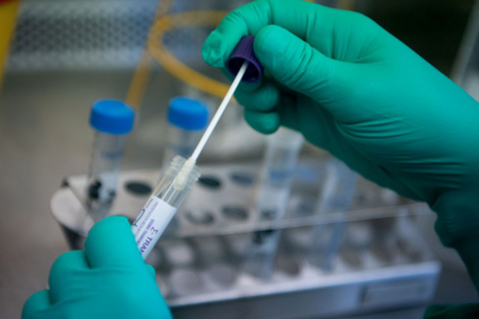 Sáng 4/6: Chú ý về hô hấp, tim mạch, sức khỏe tâm thần... khi khám hậu COVID-19