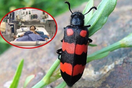 Nhiều trường hợp tử vong do ăn sâu ban miêu: Loại côn trùng này nguy hiểm như thế nào?