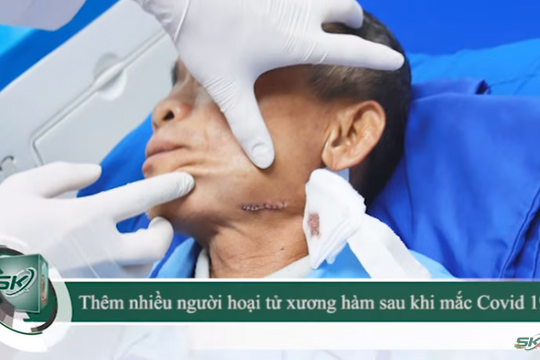 Số người bị hoại tử xương hàm sau mắc COVID-19 tăng đột biến