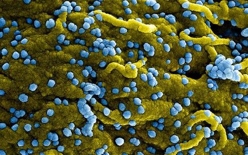 WHO cảnh báo đợt bùng phát loại virus mới, nguy cơ tử vong tới 90%