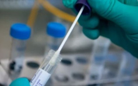 Ngày 29/7: Có 1.803 ca COVID-19, cao nhất trong 75 ngày qua; 1 F0 tử vong