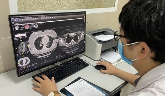 Sáng 3/8: Biến thể BA.4, BA.5 lây lan nhanh bắt đầu chiếm ưu thế; F0 bệnh nền, cần nhập viện, có thể có triệu chứng hậu COVID-19 đến 80%