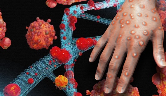 Việt Nam tăng cường tiếp cận nguồn nguyên liệu để nghiên cứu sản xuất thuốc trị bệnh đậu mùa khỉ