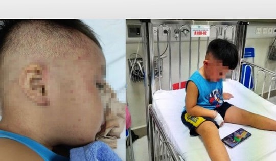 Chuyên gia cấp cứu, hồi sức nói gì về vụ bé 3 tuổi bị nhốt vào tủ cấp đông?