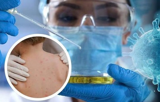 WHO cảnh báo sau khi phát hiện chó lây bệnh đậu mùa khỉ từ người