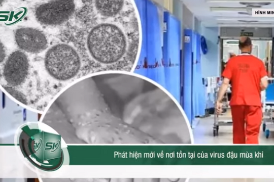 Virus đậu mùa khỉ có thể tồn tại trên bề mặt đồ vật, lo ngại lây lan như COVID-19 