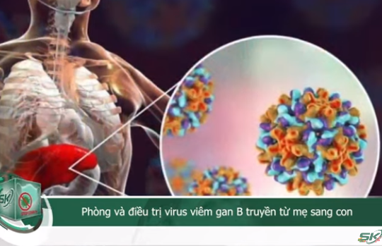 Phòng và điều trị virus viêm gan B truyền từ mẹ sang con