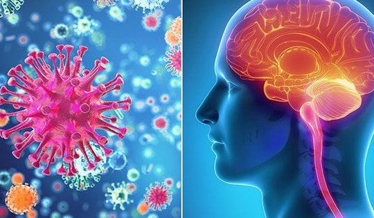 Viêm màng não mủ cần phân biệt với các loại bệnh nào?