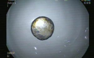 Bệnh viện nhi Thanh Hóa lấy thành công cục pin trong thực quản bé trai 11 tháng tuổi